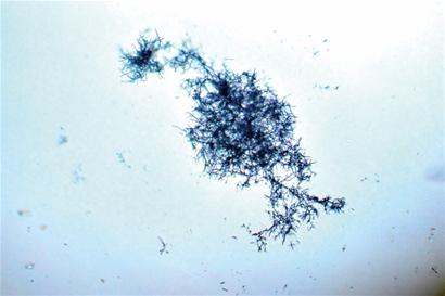 千倍显微镜下PM2.5真容：形似虫卵头皮屑