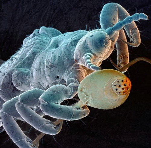 电子显微镜下的微小怪物：钩虫觅食露出尖牙