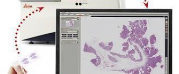 Leica 高速玻片扫描仪的应用介绍